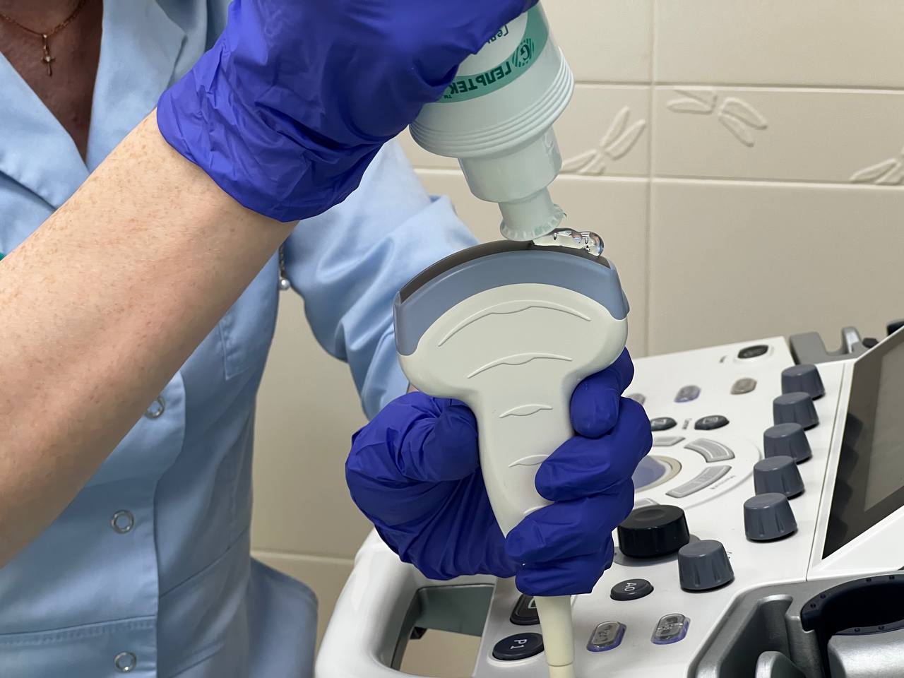 УЗИ почек и надпочечников